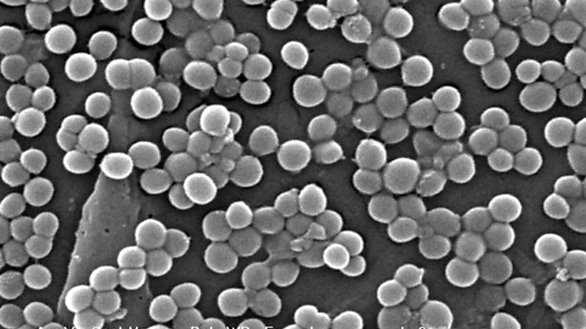 Clumps of methicillin-resistant Staphylococcus aureus bacteria (MRSA) under an electron microscope.