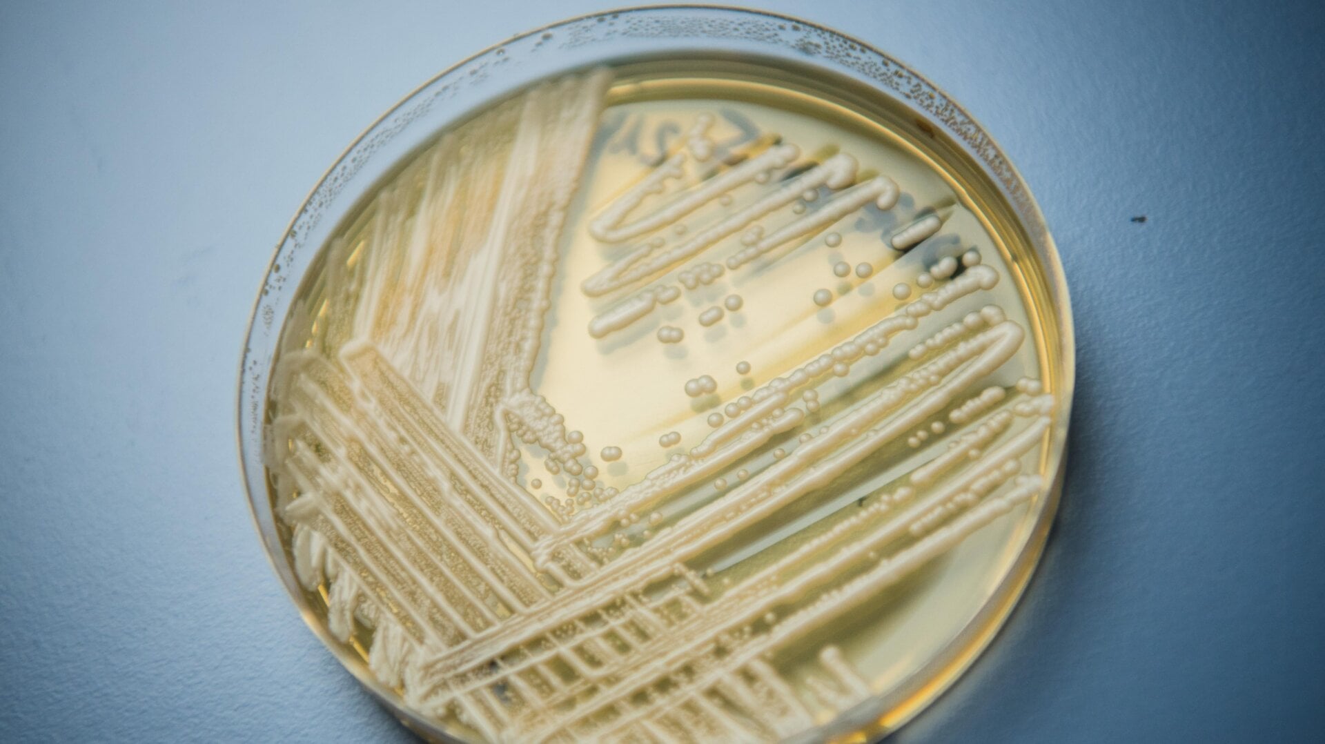 Candida auris in a petri dish.
