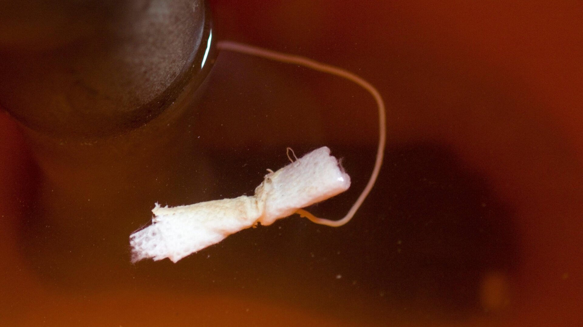 A patient with a guinea worm emerging from the leg, at the Savelugu Case Containment Center. 