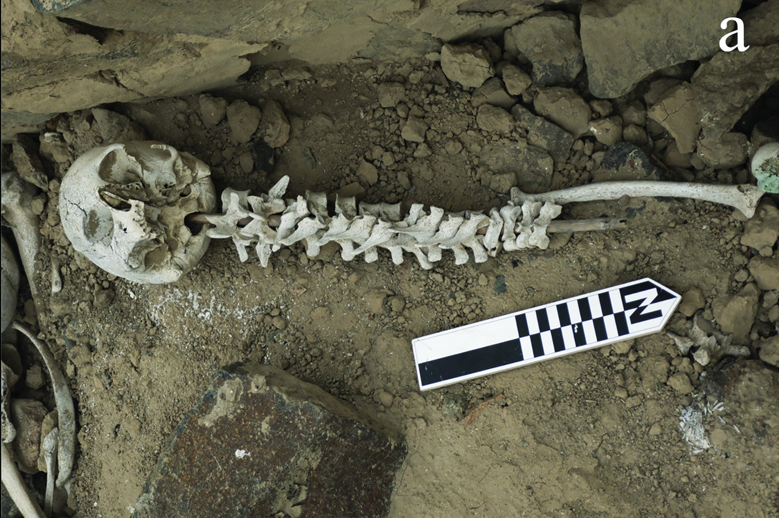 An example of a vertebrae-on-post inserted into a skull, in an apparent attempt to “reconstruct” a body. 