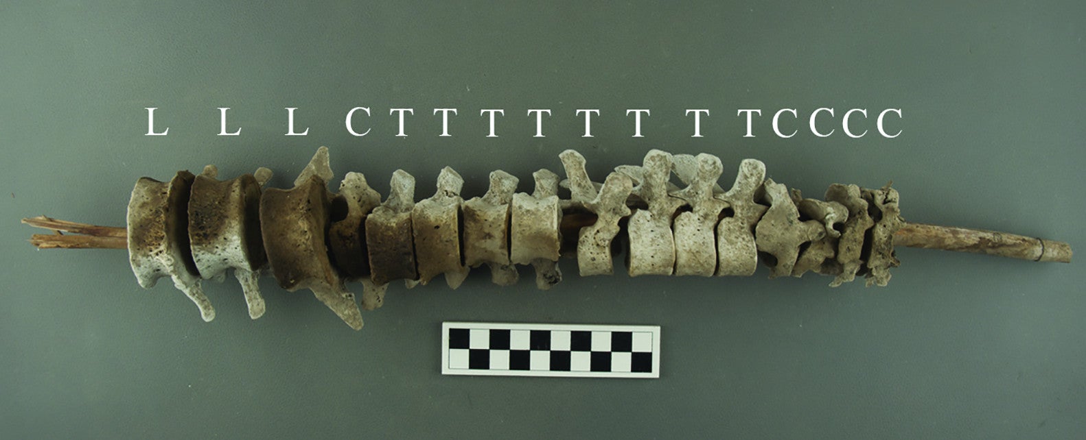 A vertebrae-on-pole shown in isolation. The annotations refer to lumbar (L), cervical (C), and thoracic (T) elements of the human vertebrae. 