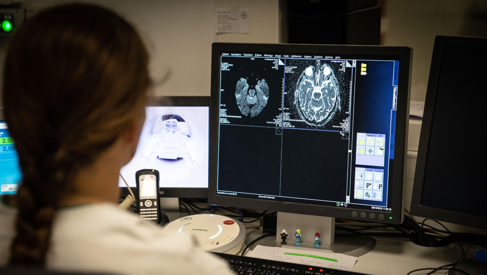 A neurologist examining an MRI.
