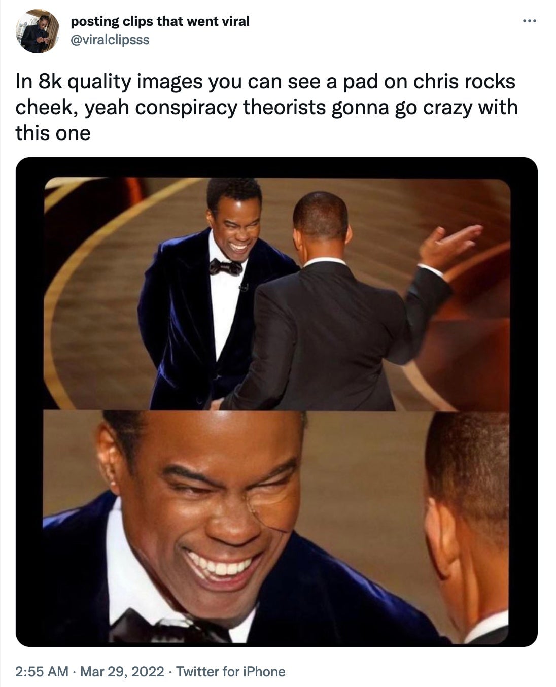 A viral image from Twitter purporting to show Chris Rock wearing a pad on his cheek before Will Smith slapped him.