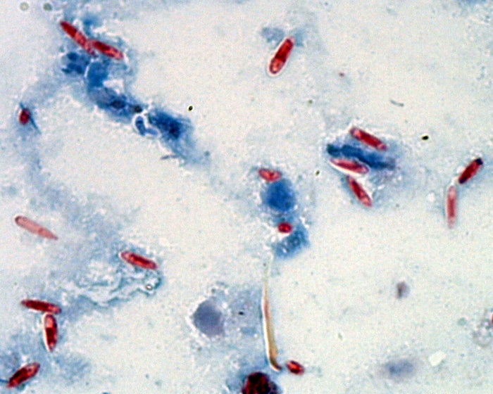Spores of the infectious fungus (the dark splotches) in a sample of tawny crazy ant tissue.