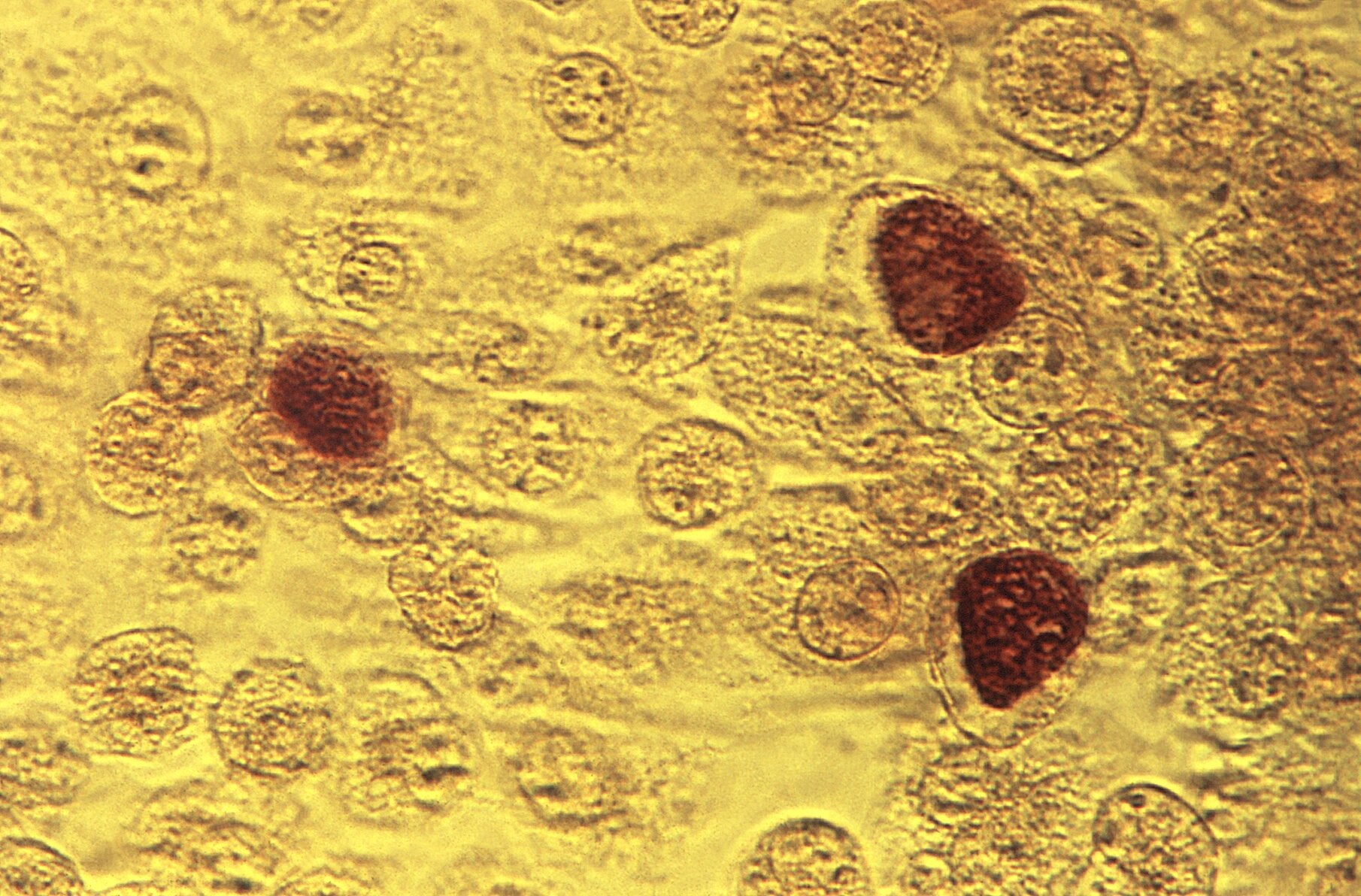 Chlamydia bacteria have a stage of life where they invade and live inside host cells, which can be seen above in the darker colored circles.