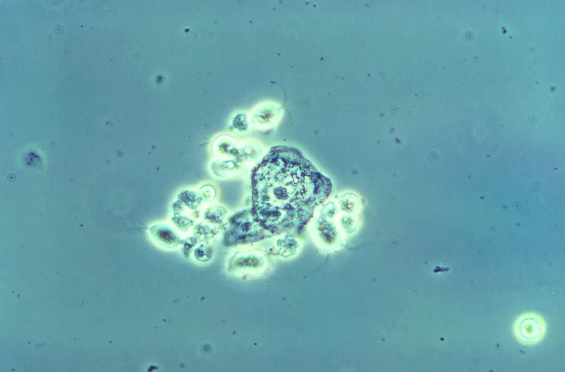 A group of Trichomonas vaginalis parasitic protozoa, collected from vaginal discharge.