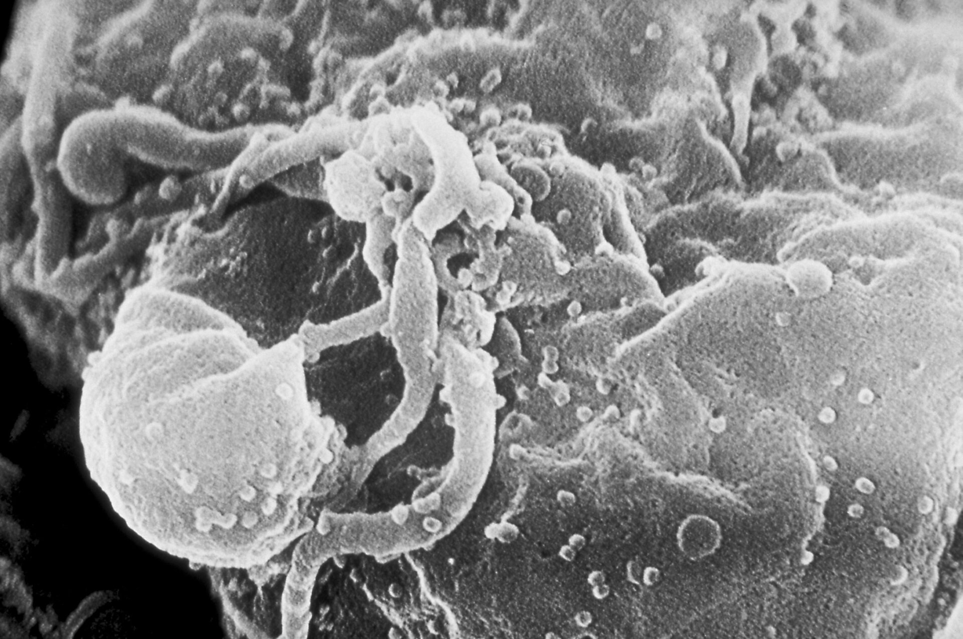 A scanning electron microscopic (SEM) image of (HIV-1) virions, seen as small round bumps.