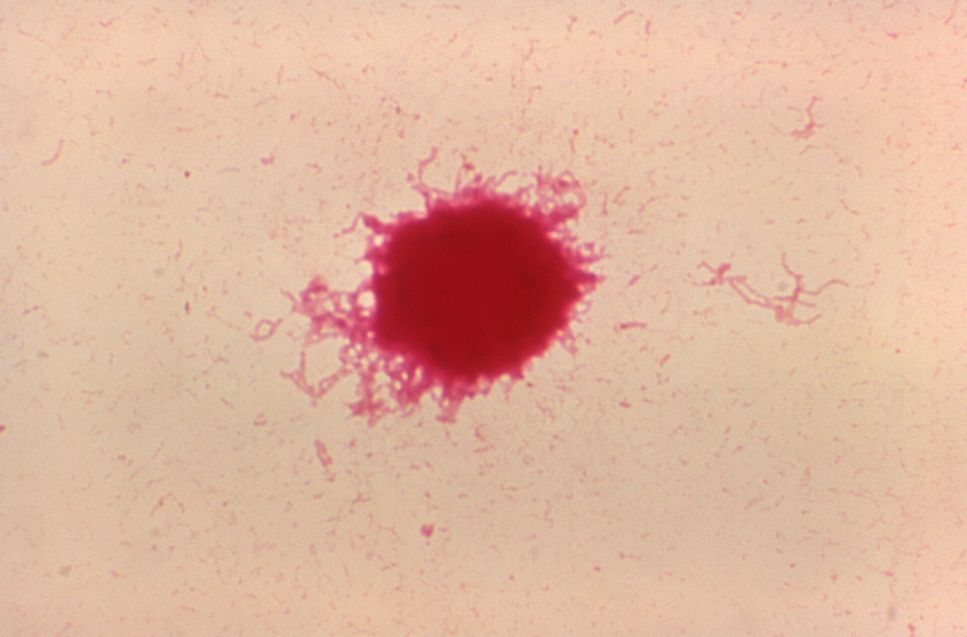 A clump of Haemophilus ducreyi bacteria found in a sample of rabbit blood