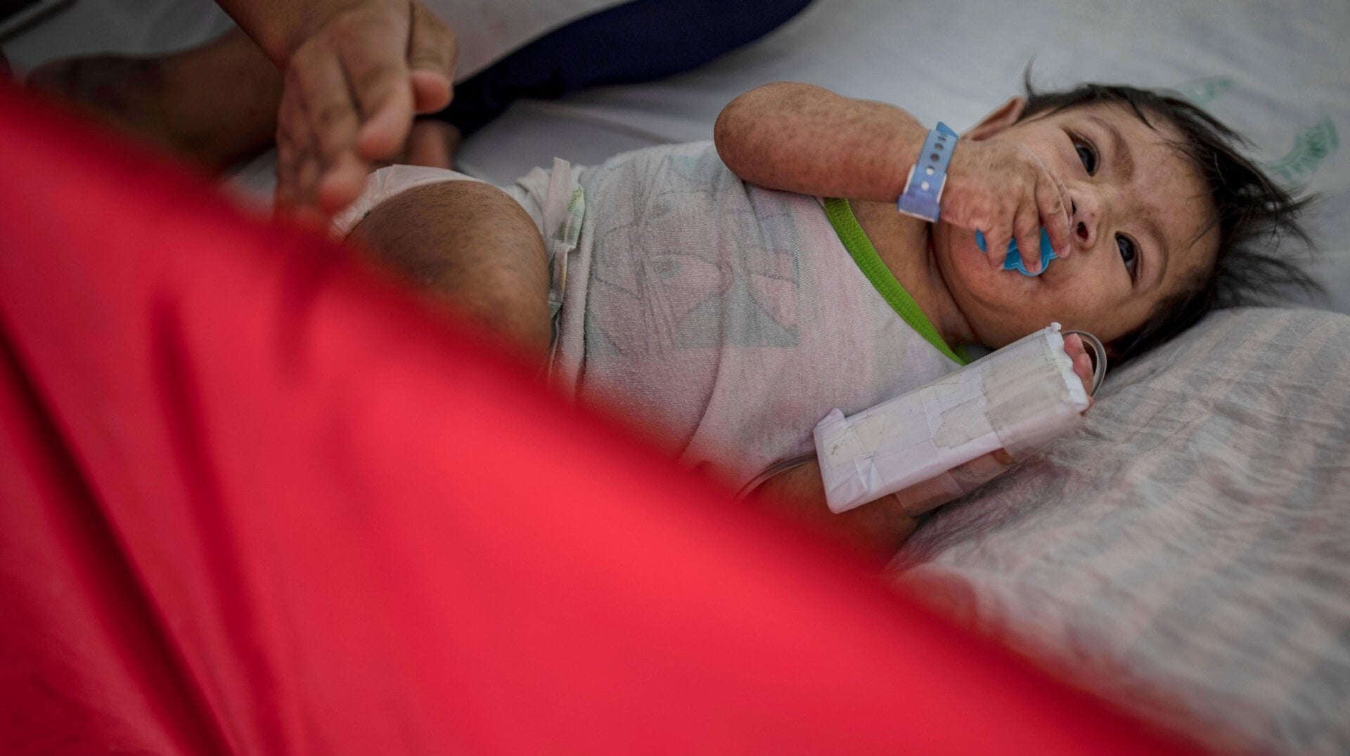 A child suffering from measles is treated at a  hospital on May 4, 2019 in Manila, Philippines.