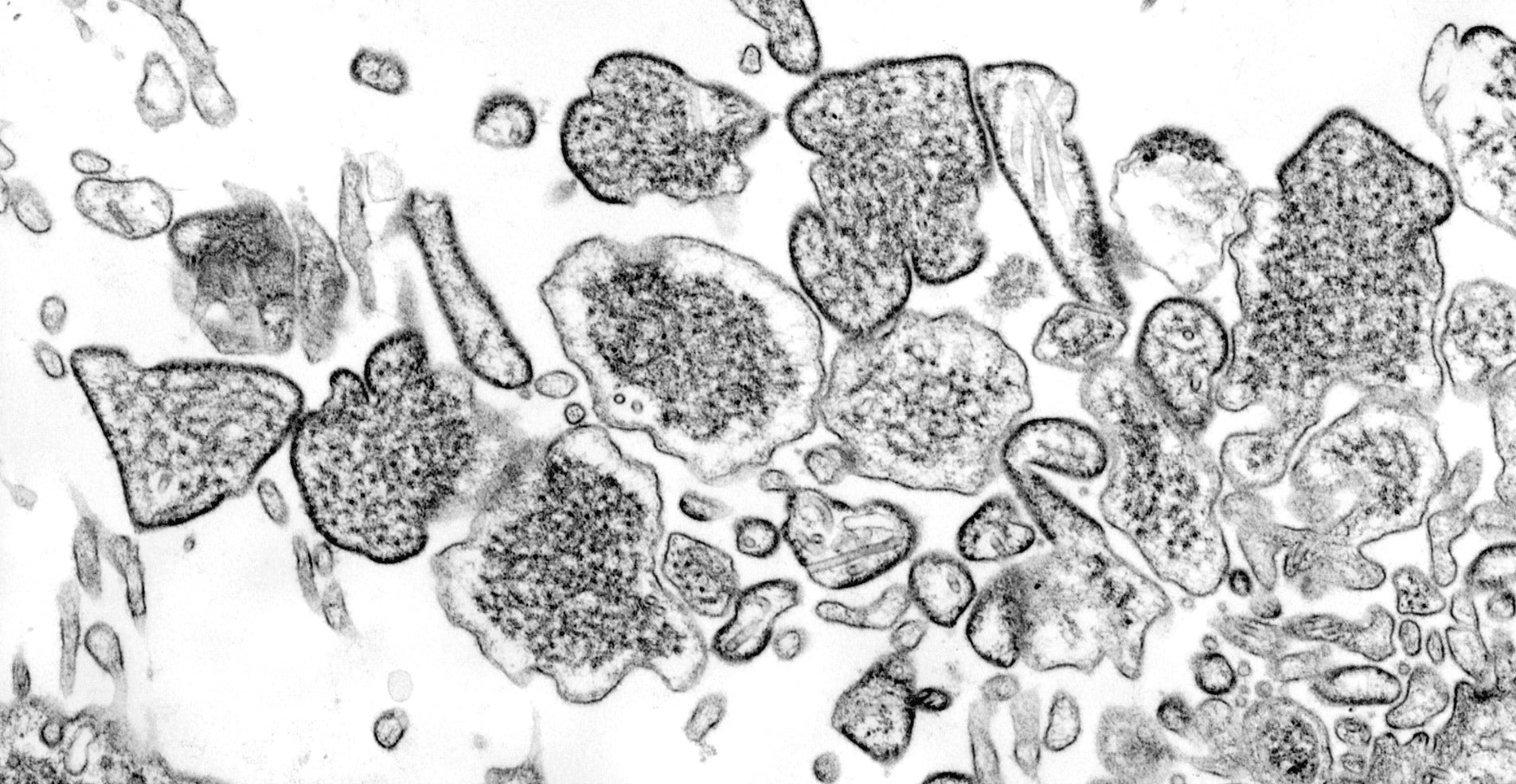 Nipah virus particles that have been isolated from a patient’s cerebrospinal fluid.