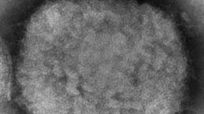 An electron microscope image of a single monkeypox virus.