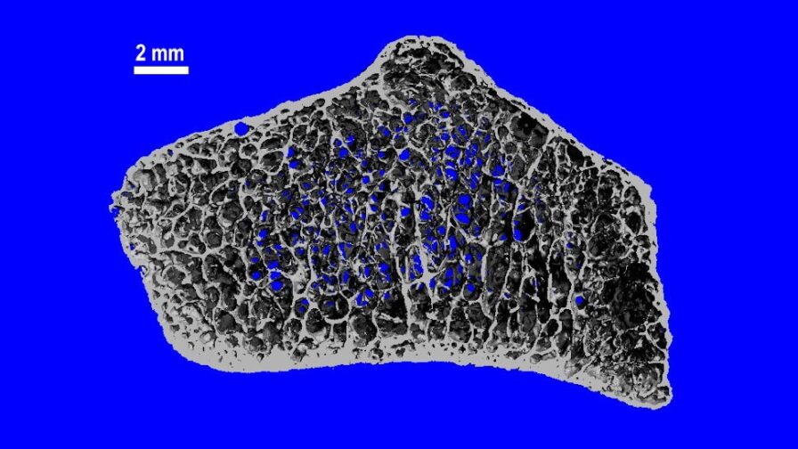 Astronauts Can Suffer a Decade of Bone Loss During Months in Space, New ...