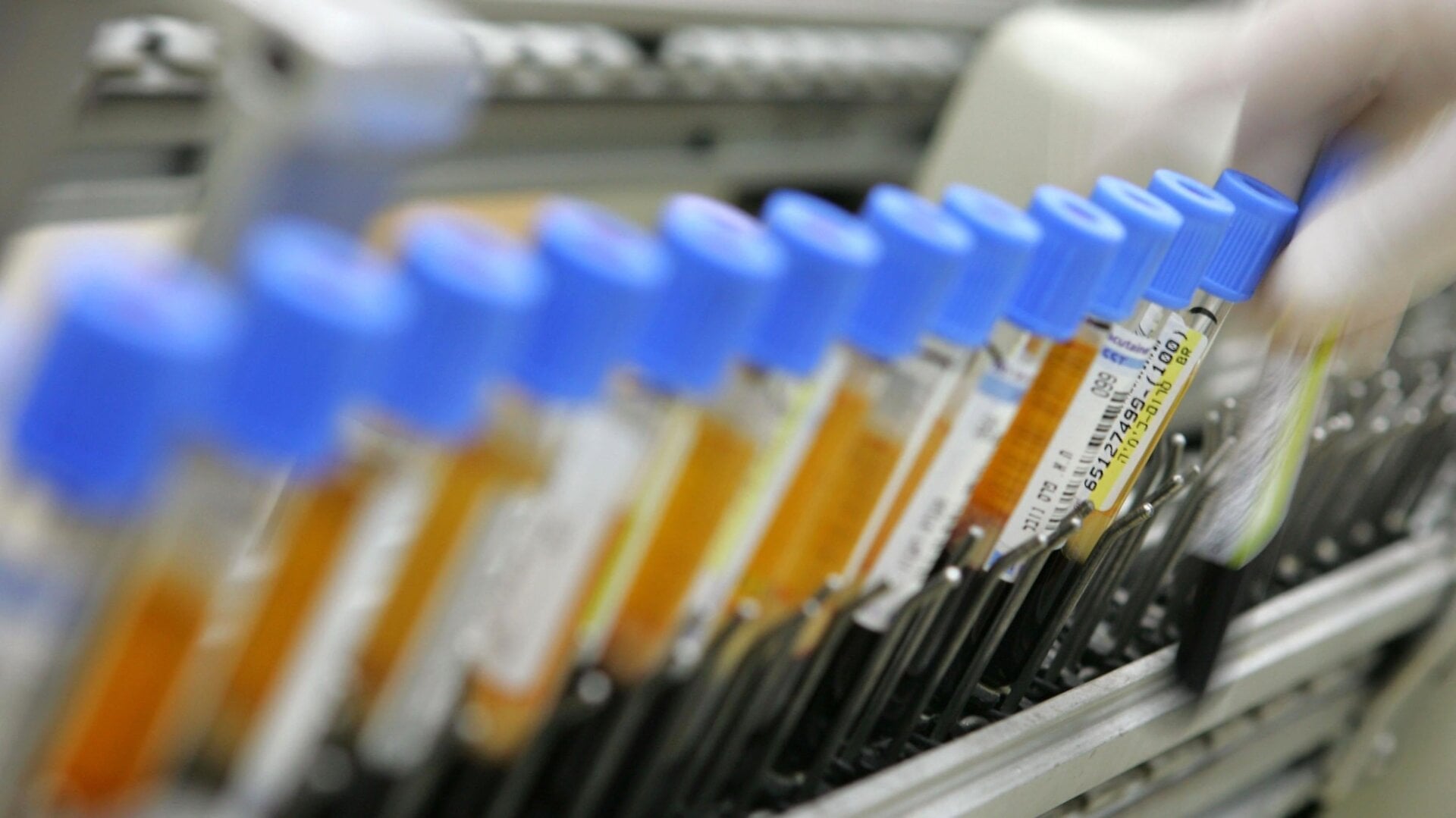 A laboratory technician places human blood samples on an automated testing line at the Maccabi Health Services HMO central laboratory January 22, 2006 in Nes Tsiona which is located in central Israel.