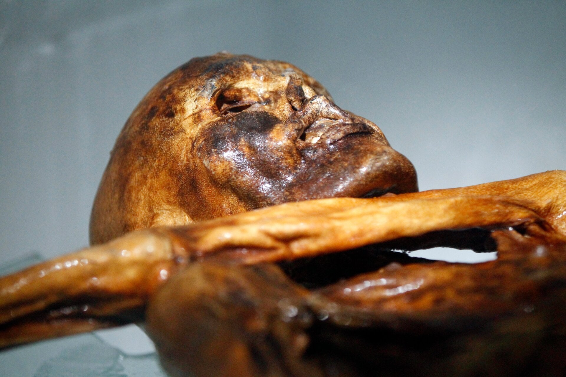 Ötzi, a 5,300-year-old mummy discovered in 1991.