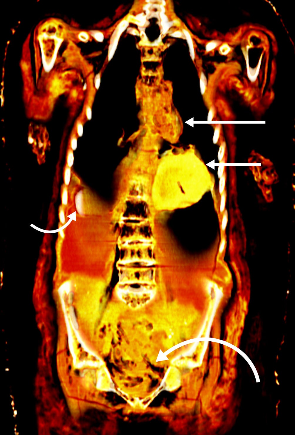 A CT scan of the mummy’s abdominal cavity.