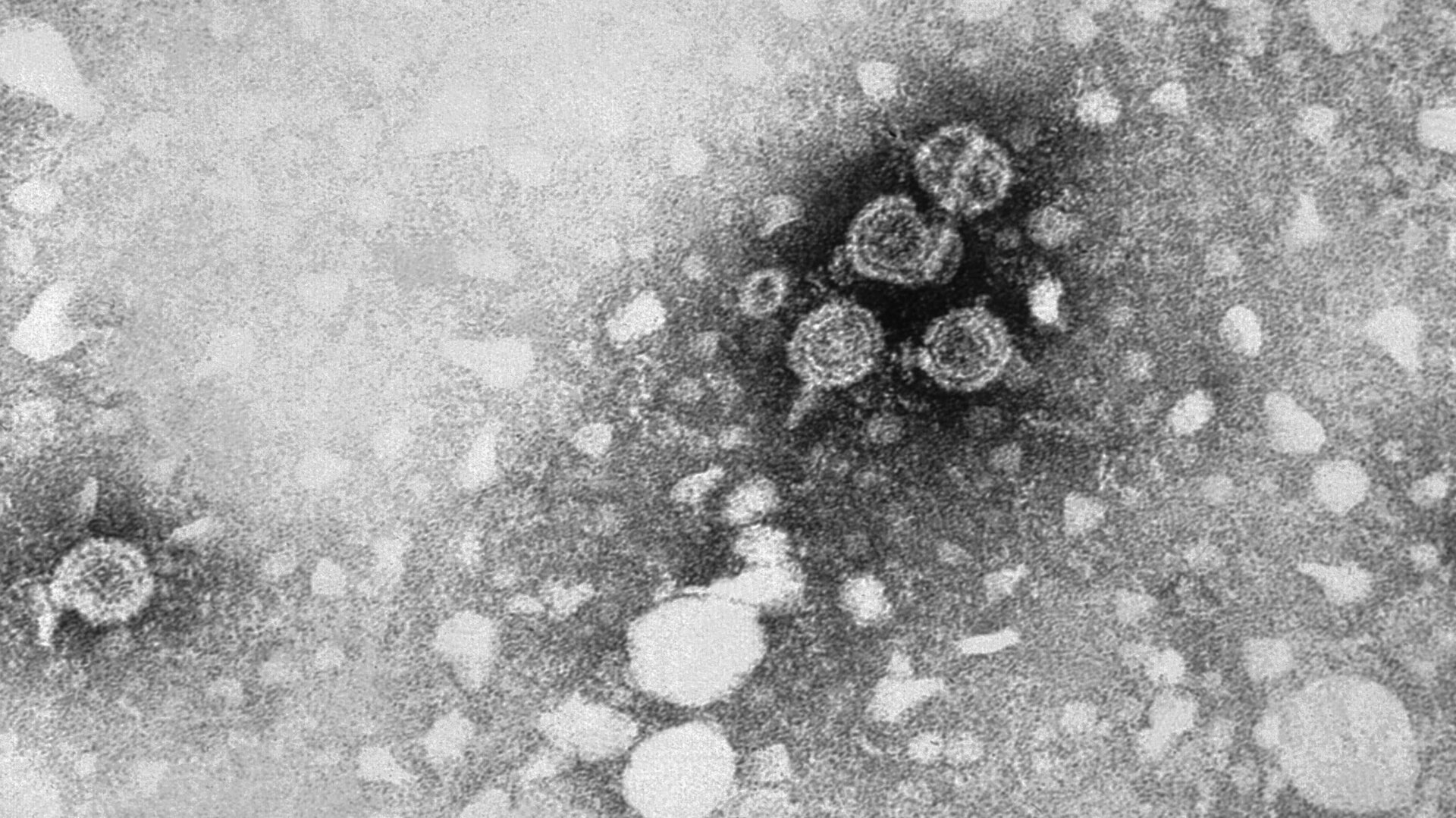 A transmission electron microscopic (TEM) image of hepatitis B virus (HBV) particles.