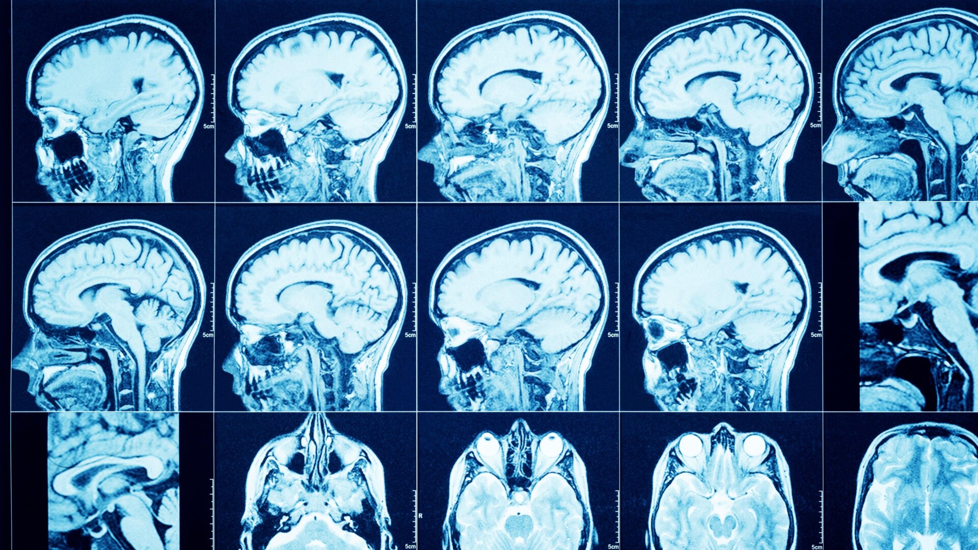 Generic images of the brain