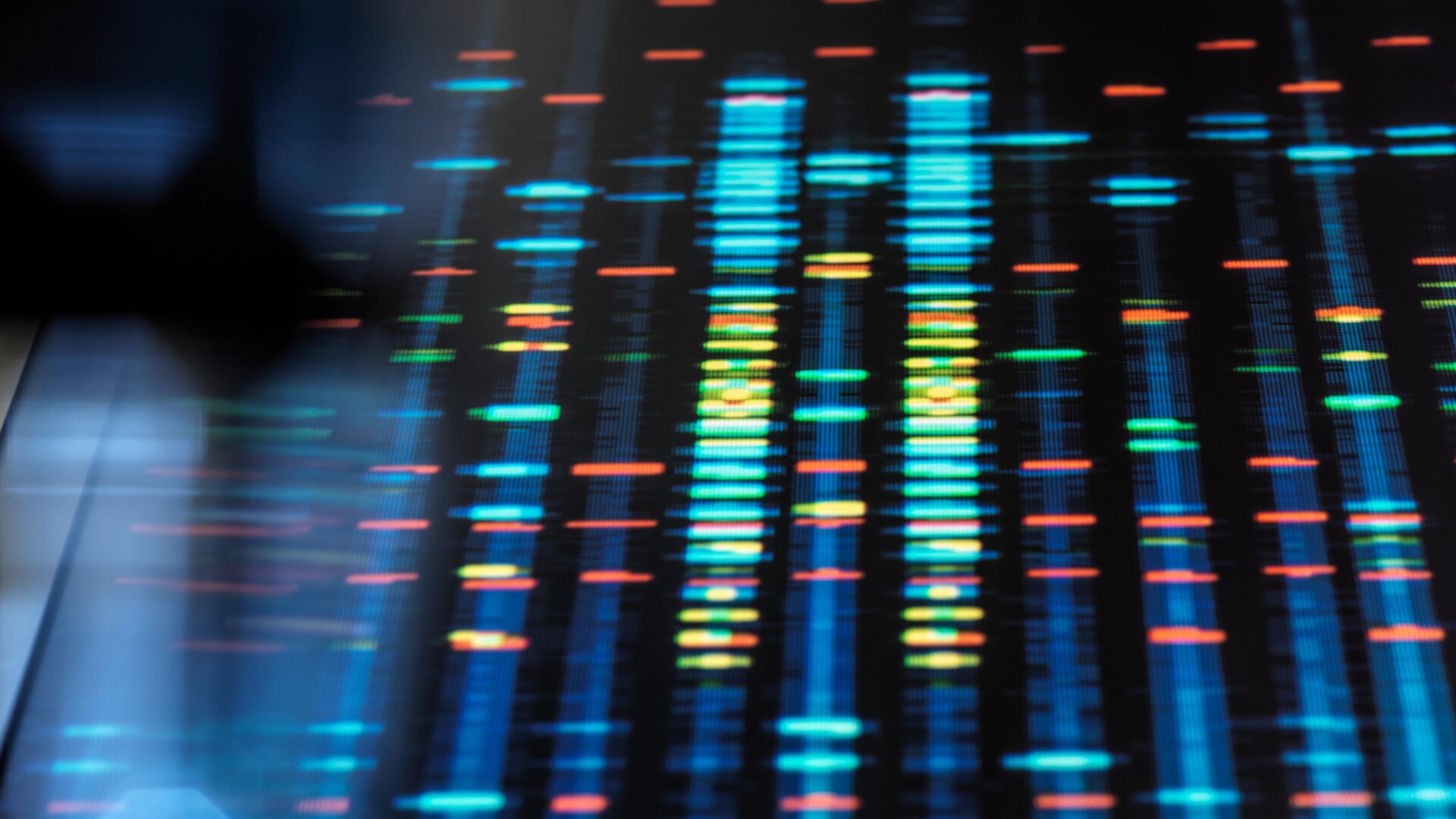 A DNA (deoxyribonucleic acid) profile from a human sample.