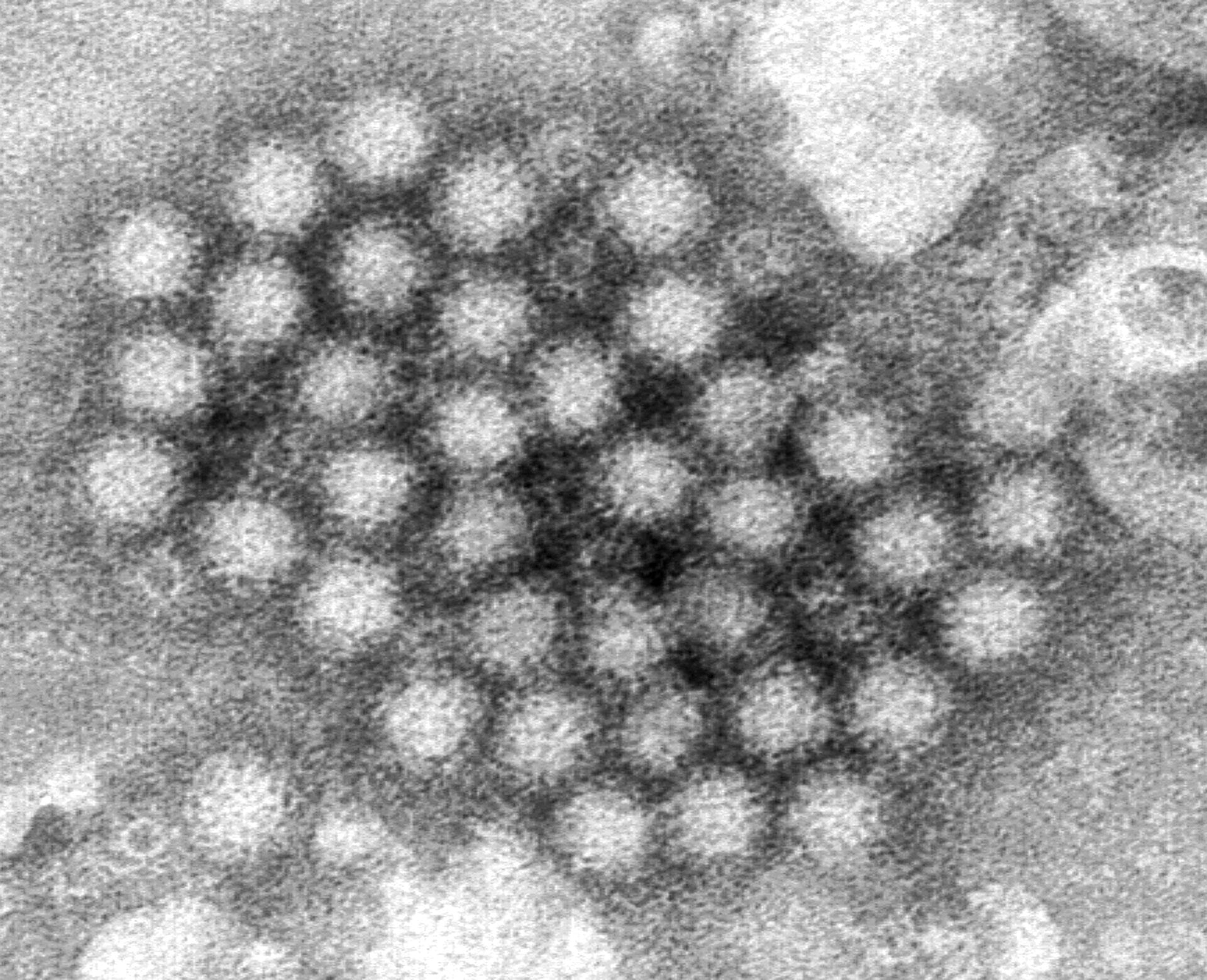 An electron microscope image of norovirus particles.