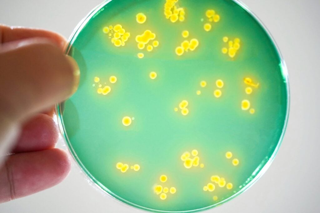 ‘Flesh-Eating’ Bacteria Is Having a Killer Summer