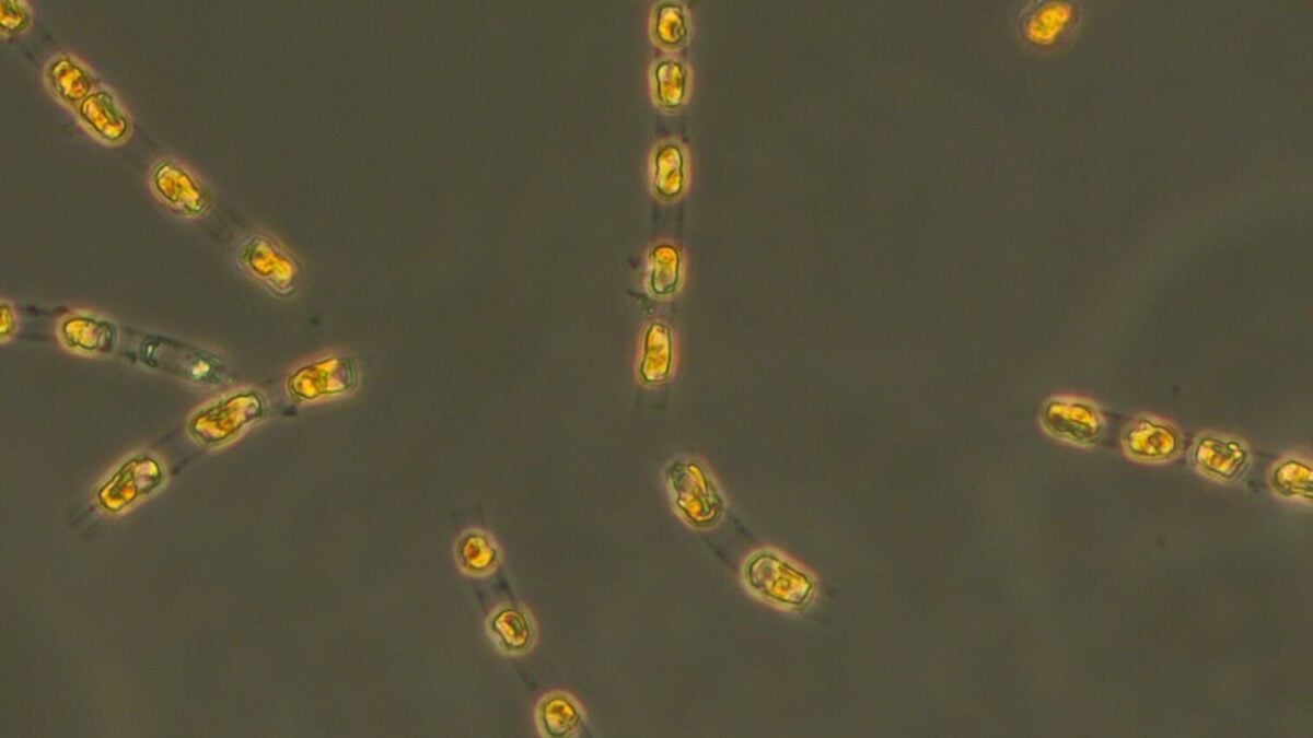 Buried for Millennia, Scientists Coax 7,000-Year-Old Algae Back to Life