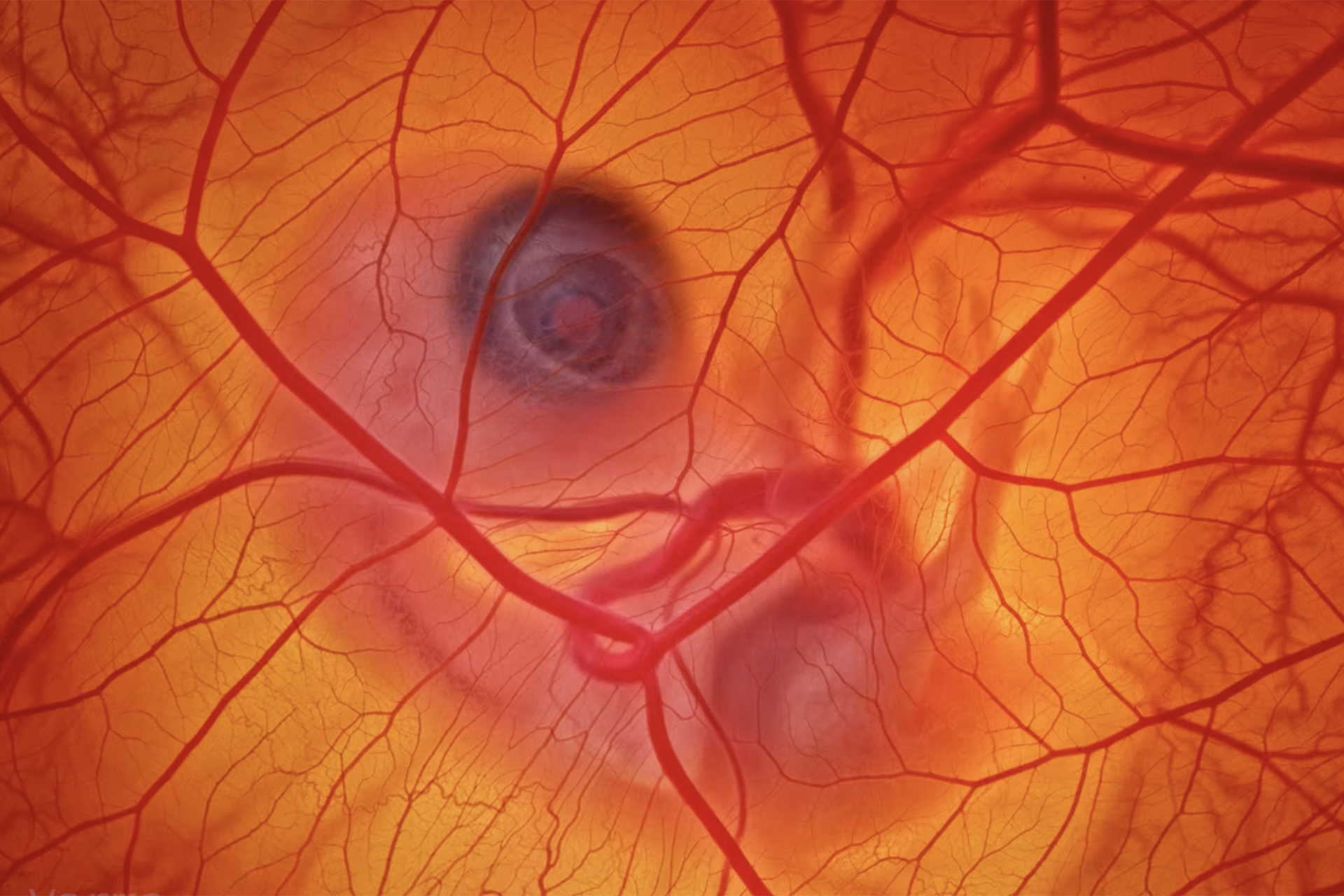 Anand Varma image of egg