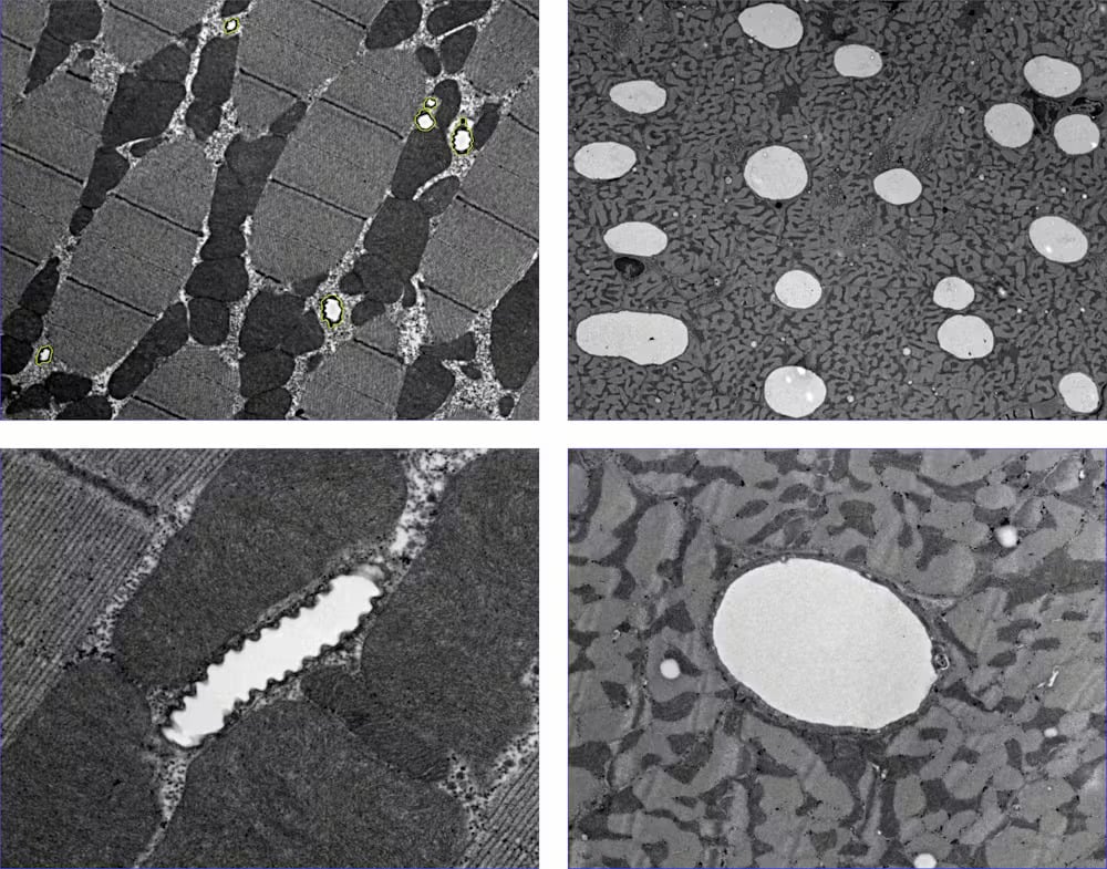 Electron Microscope Images Flight Muscles