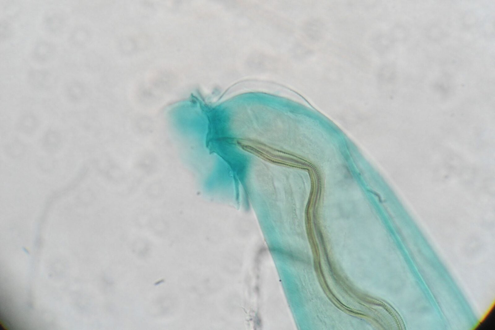 A Brain-Invading Worm Spread By Rats and Snails Has Reached California