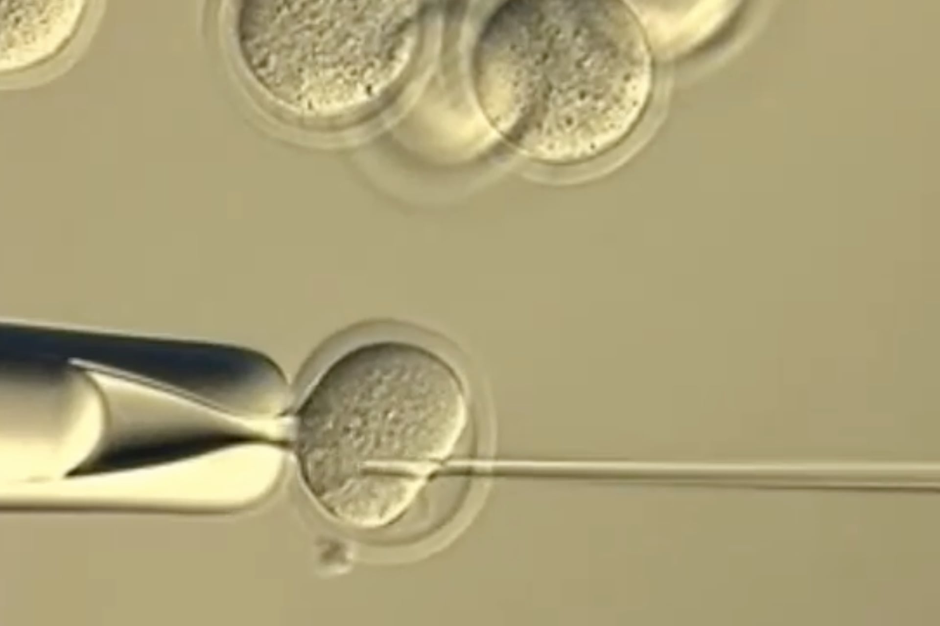 Above, researchers in Japan inject of a somatic cell nucleus for cloning, after the removal of the nucleus from another previously cloned mouse egg.