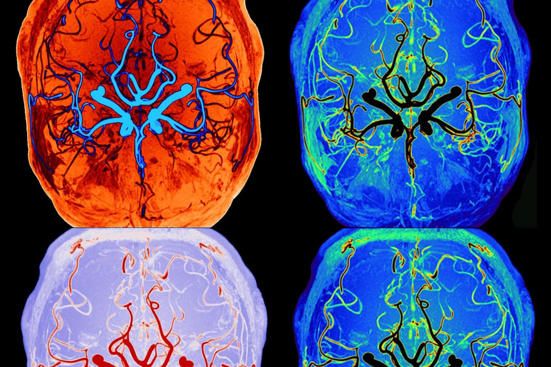 Above, brain scan art released by the University of Oulu to accompany their research into how the brain cleanses itself during sleep.