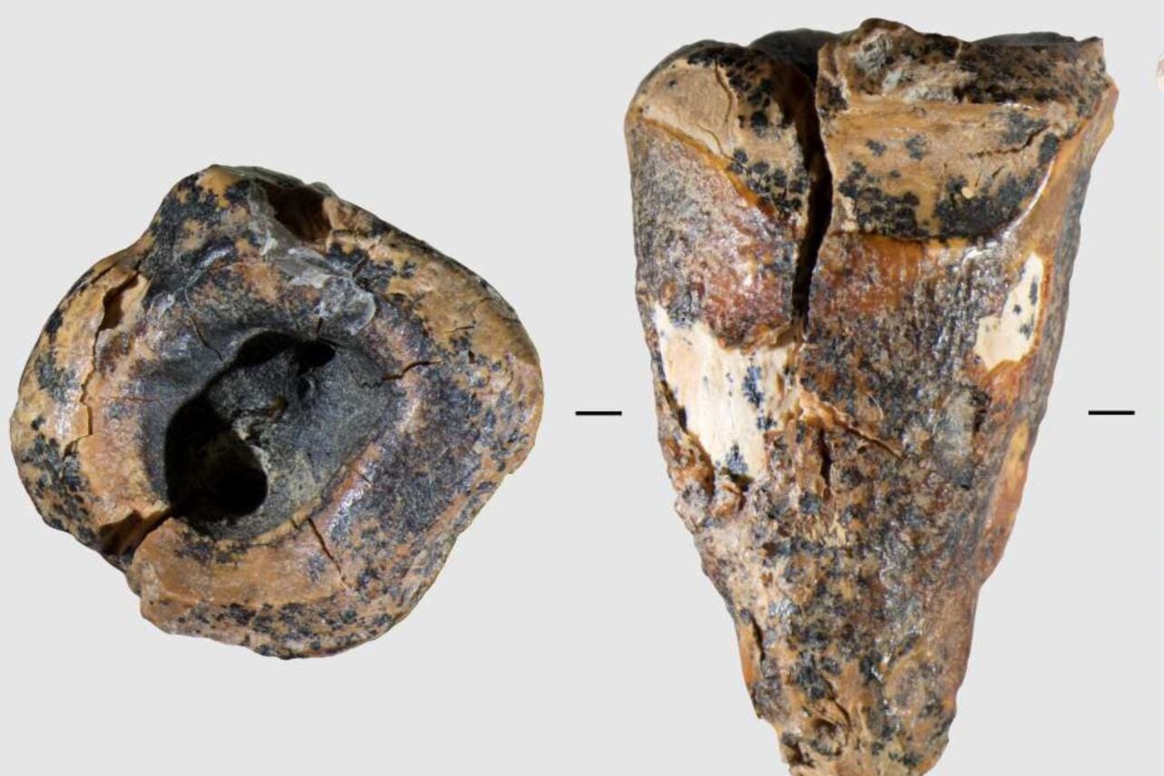 Neanderthal Dentists Treated Cavities With Stone Drills. Yes, Really