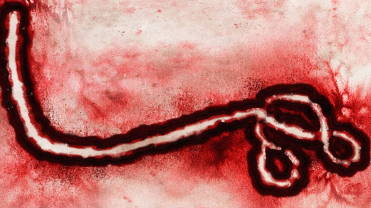 Ebola Outbreak Tops 500 Suspected Cases as American Tests Positive