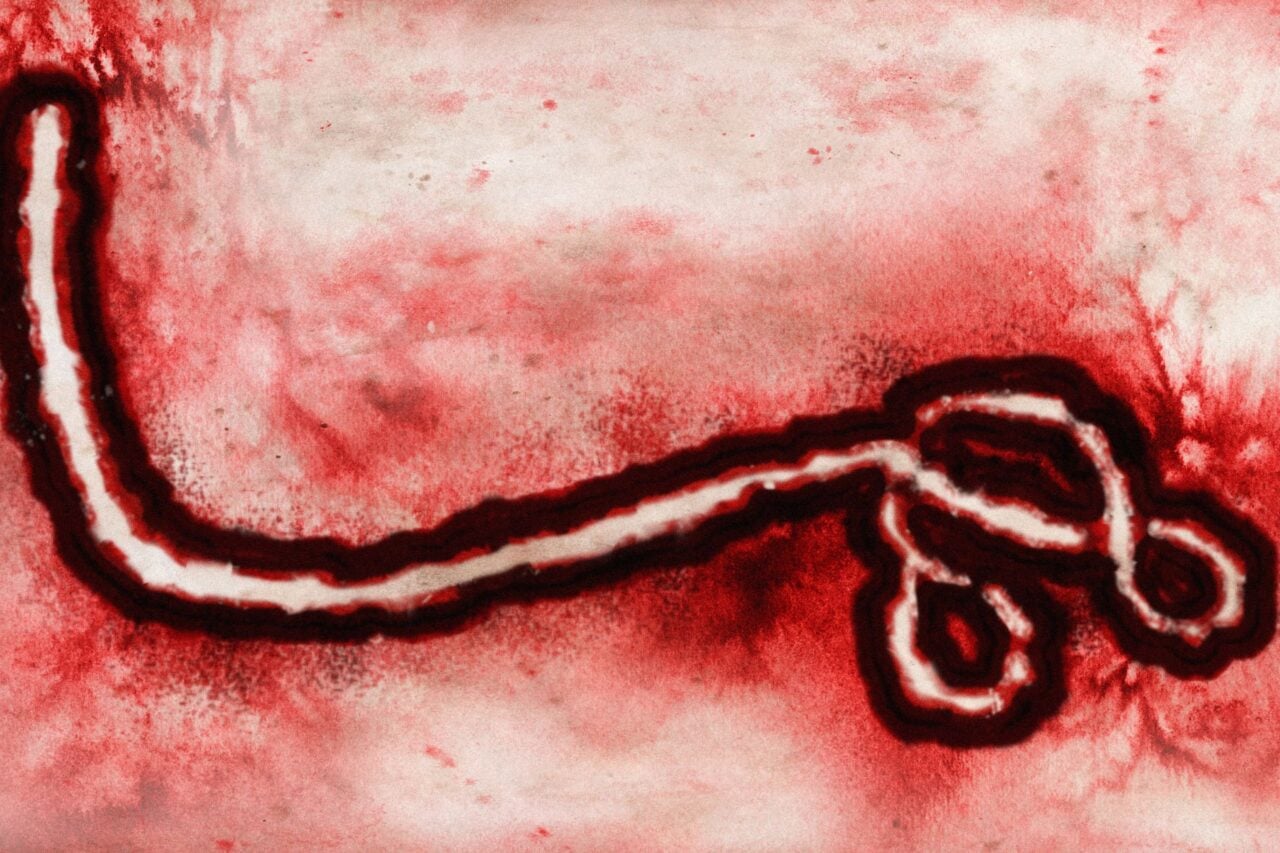 Ebola Virus