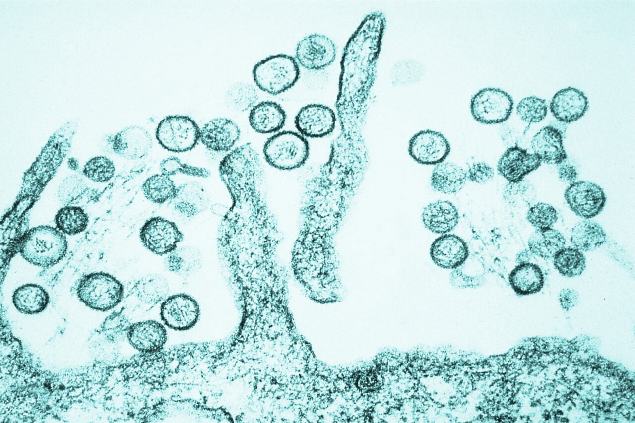 Sin Nombre Hanta Virus