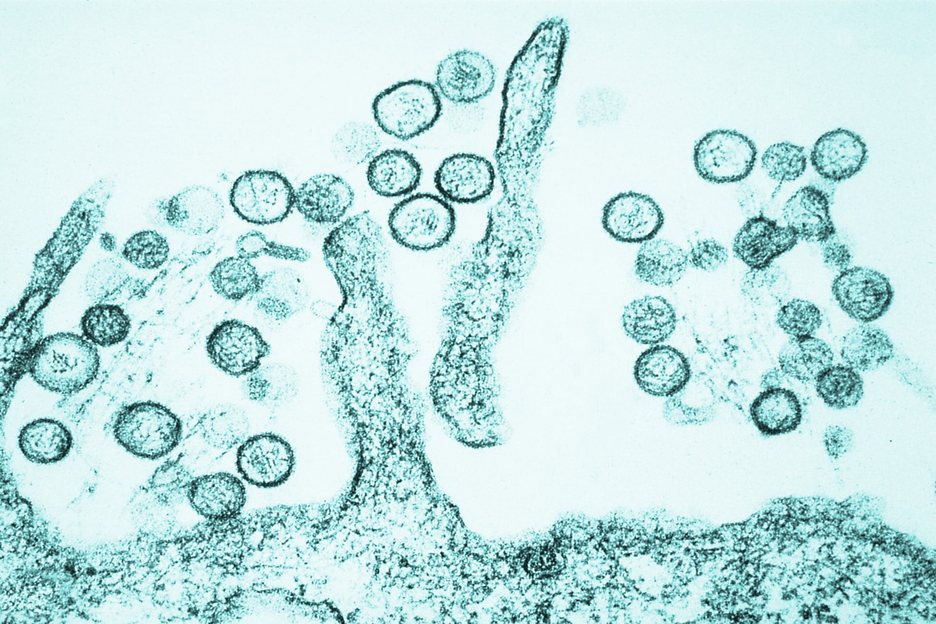 Transmission electron micrograph of Sin Nombre virus.
