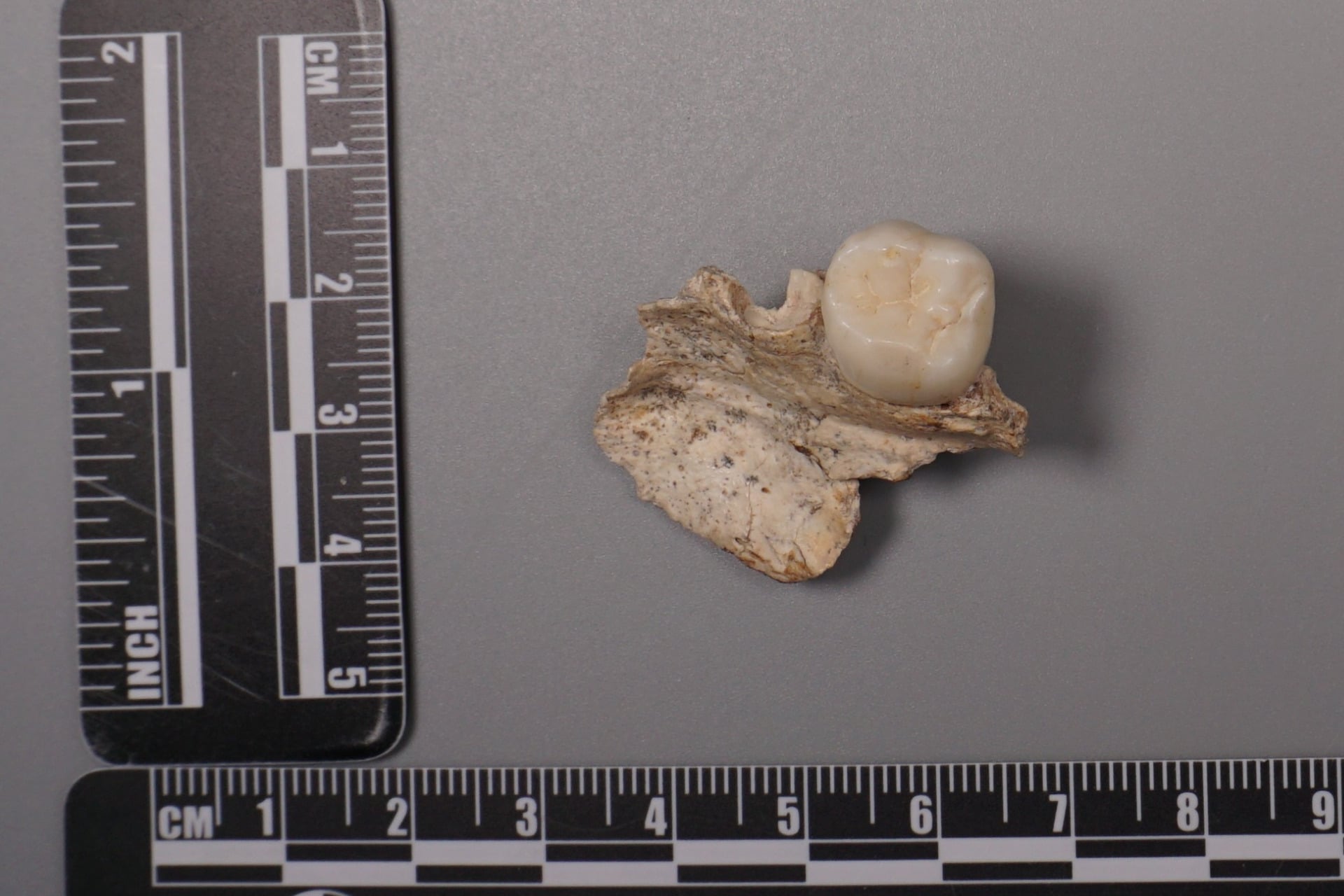 Another H Erectus Tooth