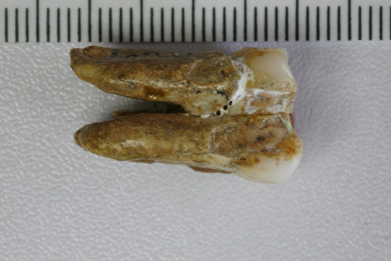 This Human DNA Tweak Came From a Distant Relative—But Not in the Way You’d Think