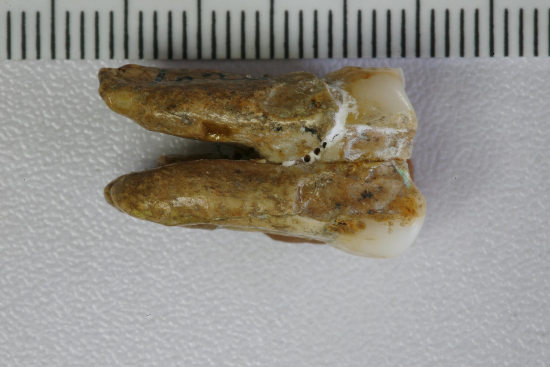 H. erectus tooth from the Zhoukoudian site. 