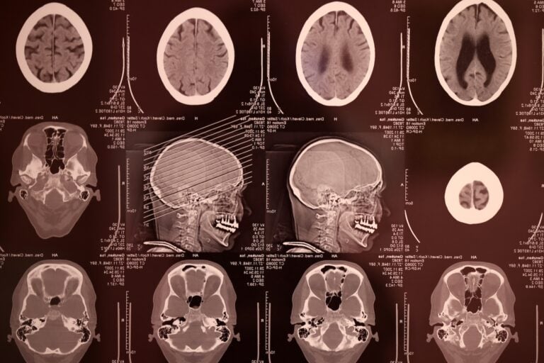 Meta's AI Is Getting Better at Reading Your Thoughts