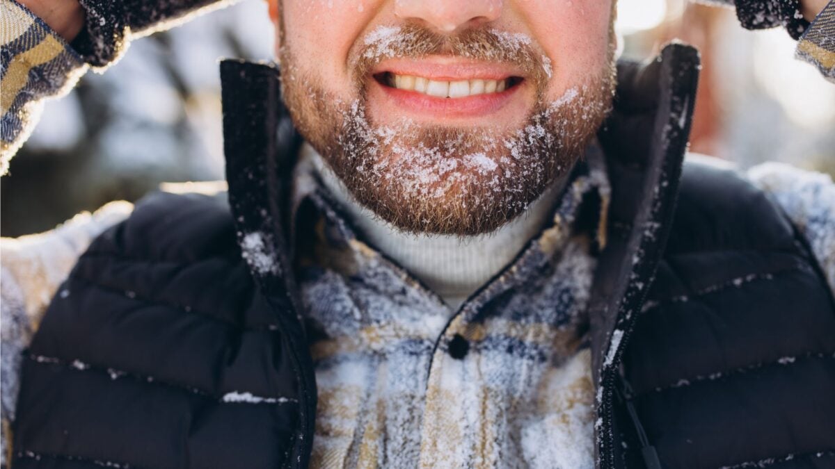 photo of Scientists Are Trying to Freeze Strokes Before They Damage the Brain image