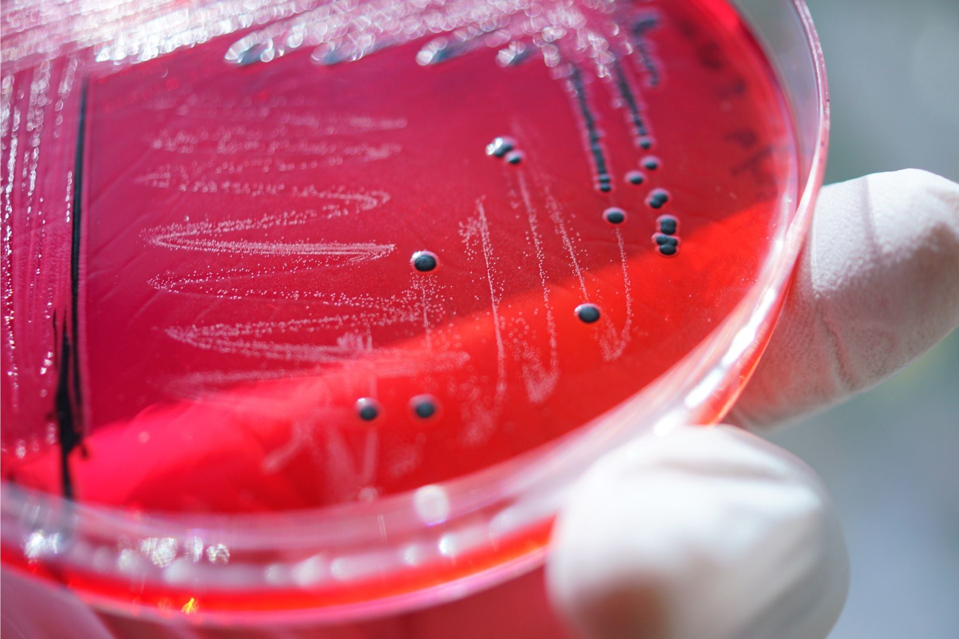 Salmonella Typhimurium bacteria being grown on a Petri dish. These bacteria are a leading cause of foodborne illness.