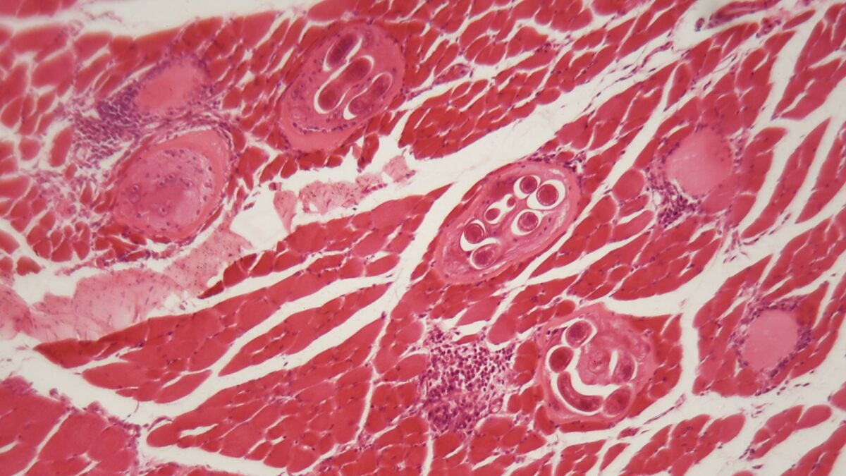 Tainted Beef Jerky Caused an Outbreak of Bear Worms