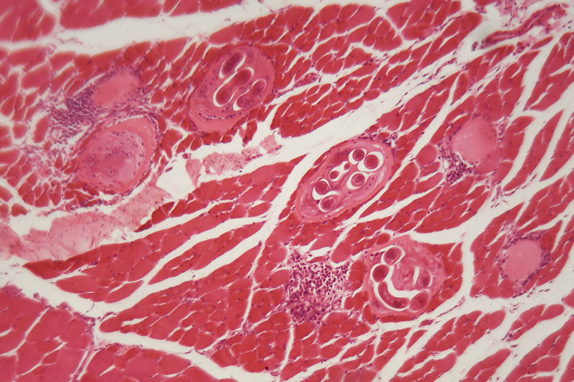 Trichinella spiralis larvae in muscle tissue viewed under a microscope.