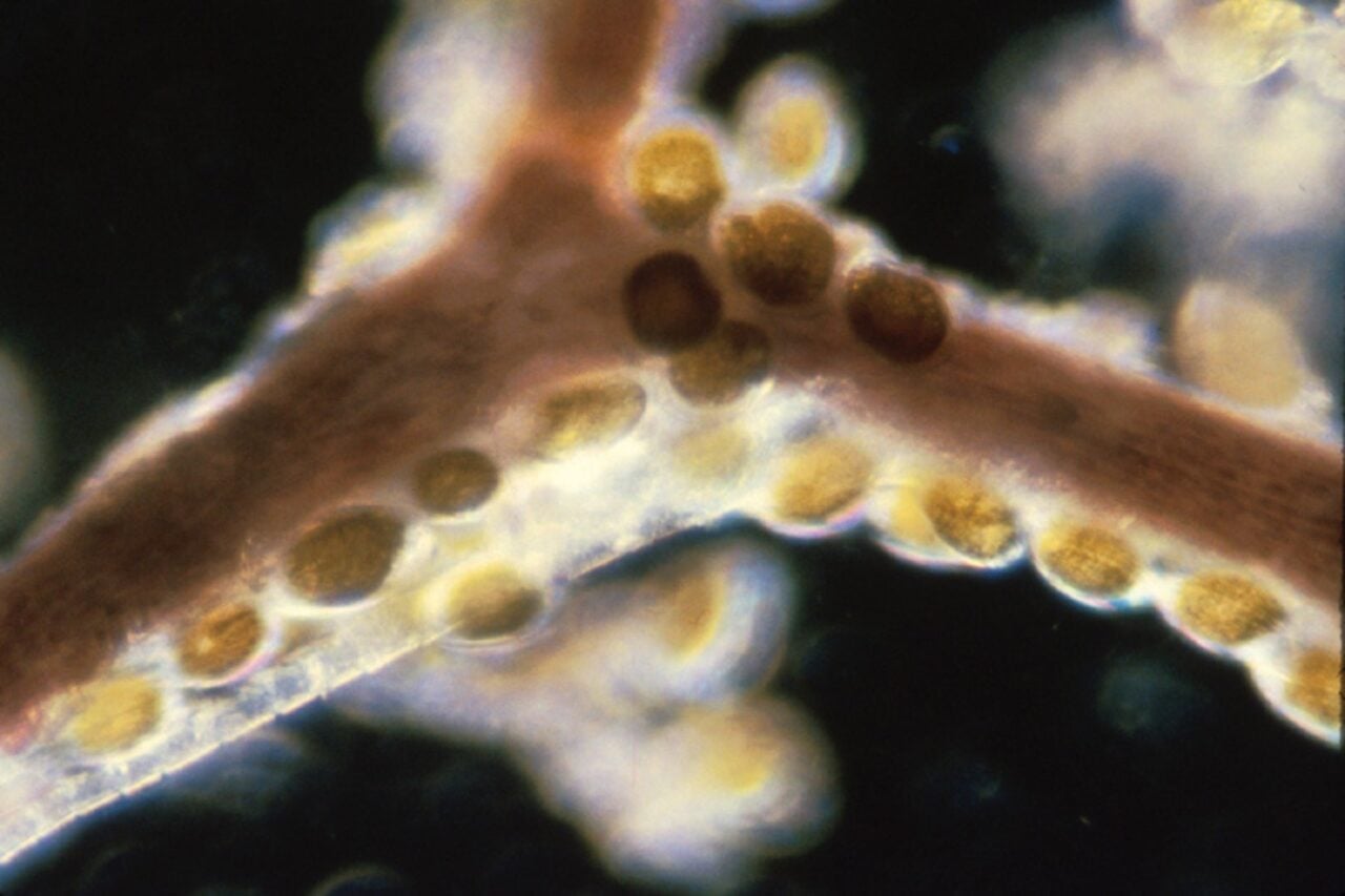 These Seafood Toxins Survive Cooking—and They’re Fueling Foodborne Outbreaks
