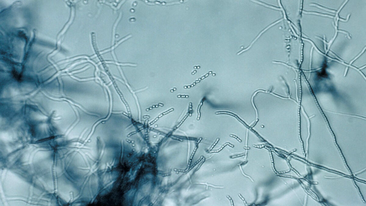 New Antibiotic Found in Dirt Targets Bacteria in a Way &lsquo;Never Been Seen Before&rsquo;