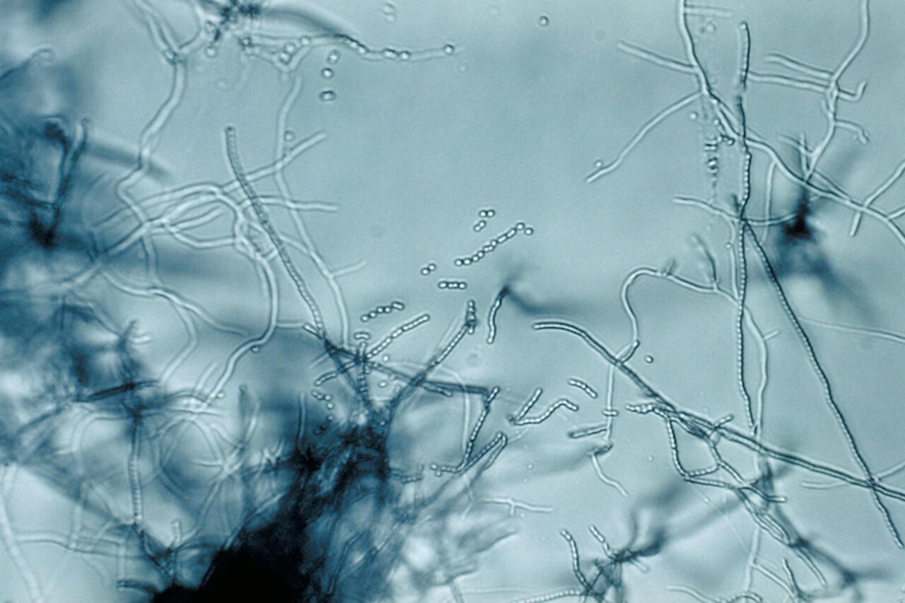New Antibiotic Found in Dirt Targets Bacteria in a Way ‘Never Been Seen Before’