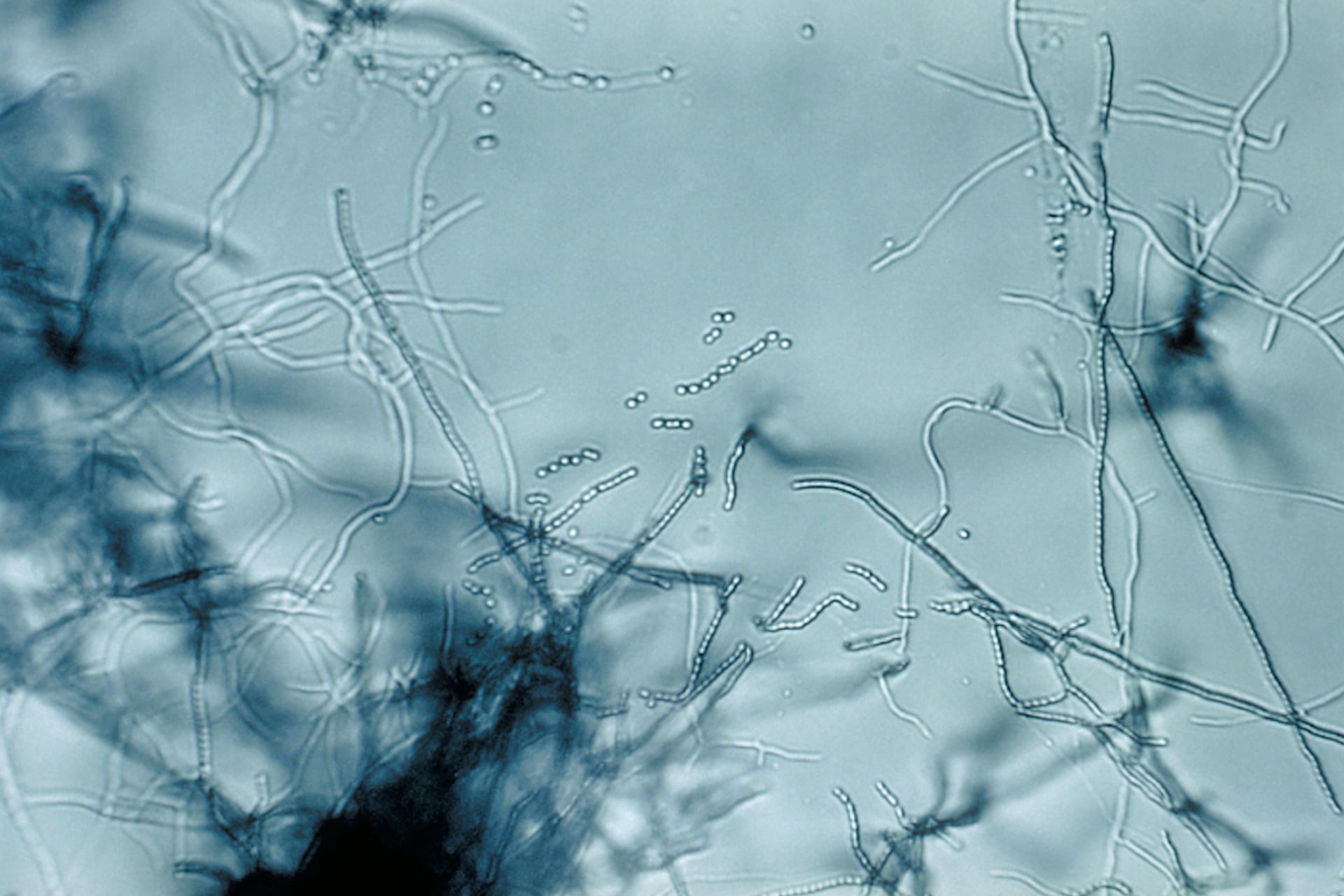 A slide culture of a bacteria in the Streptomyces genus. Researchers drew the new antibiotic from the soil-dwelling bacterium Streptomyces rimosus.