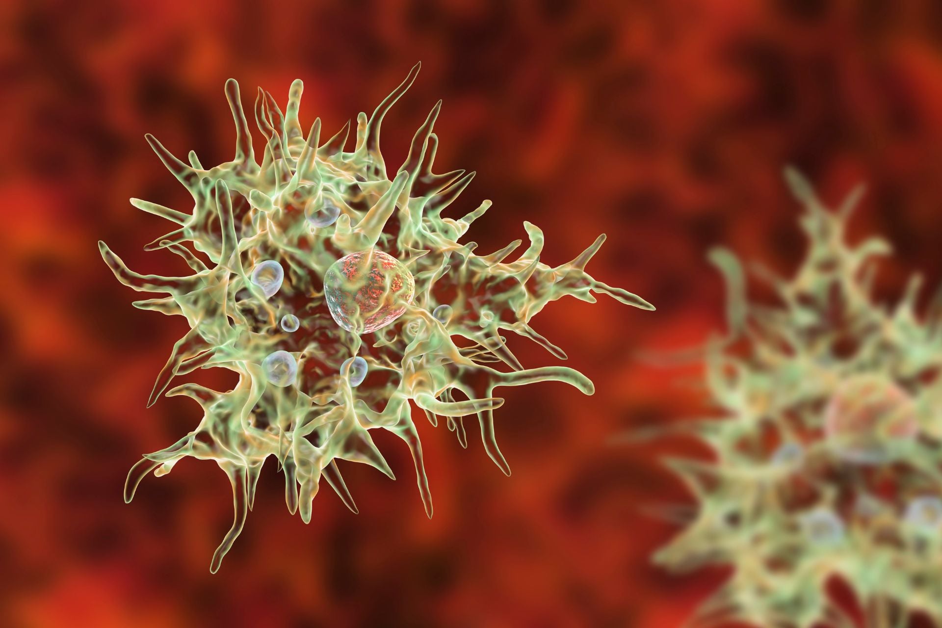 An illustration of Acanthamoeba castellanii, a common cause of acanthamoeba keratitis.