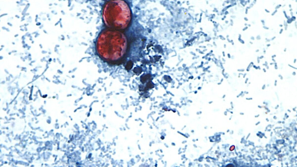 Oh Great, a Parasite That Causes Explosive Diarrhea Is Spreading Right Now