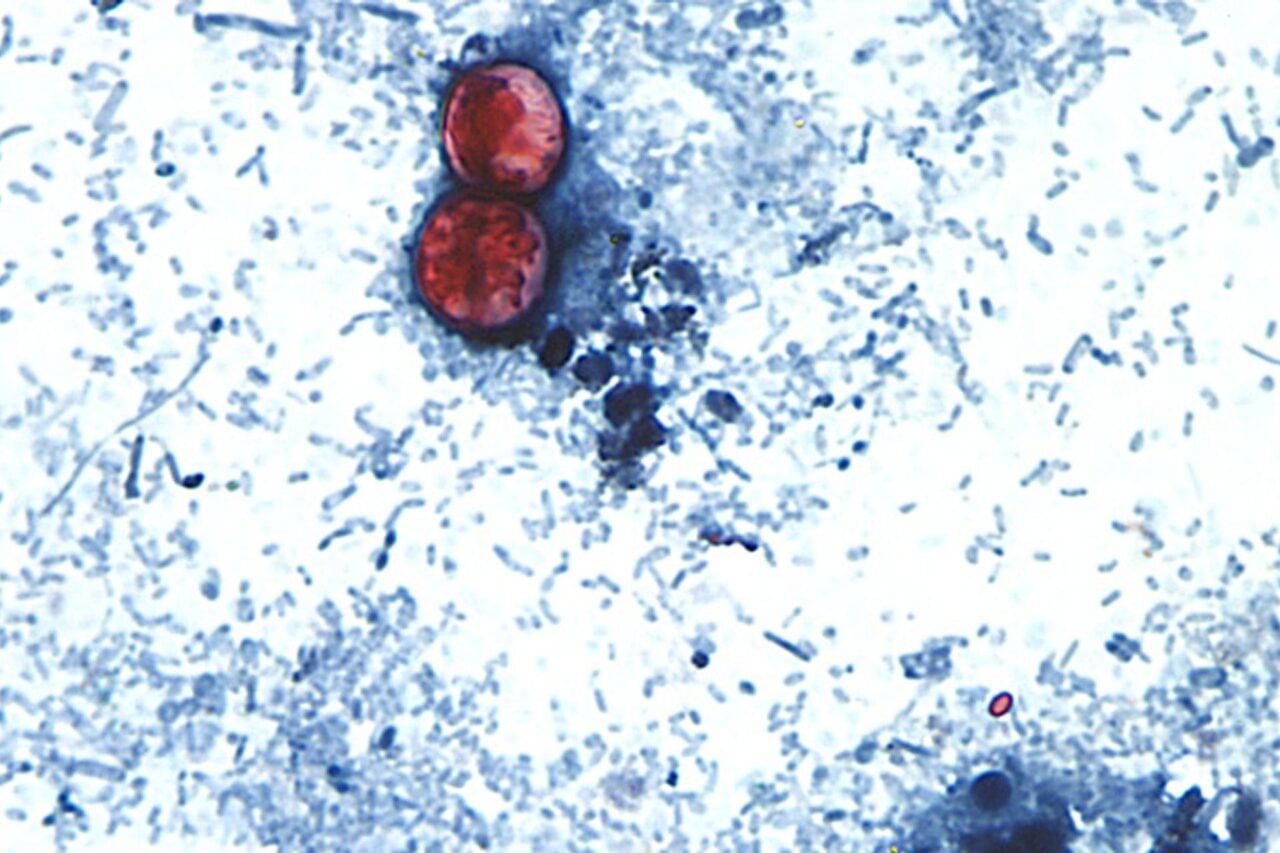 Cyclospora Oocysts